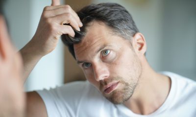 Top Hair Loss Treatments for Men and Women