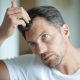 Top Hair Loss Treatments for Men and Women