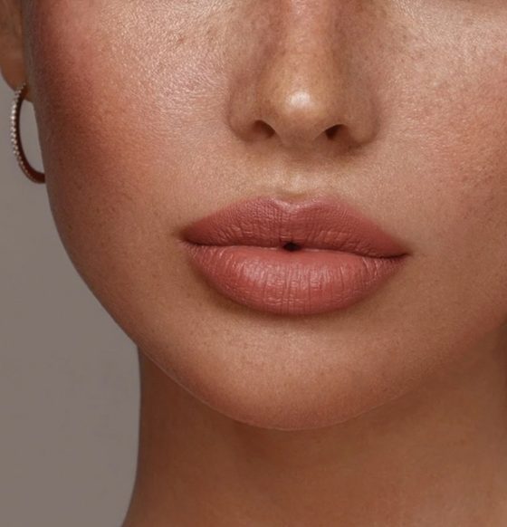 Where to Find the Best Lip Filler Prices in Washington DC