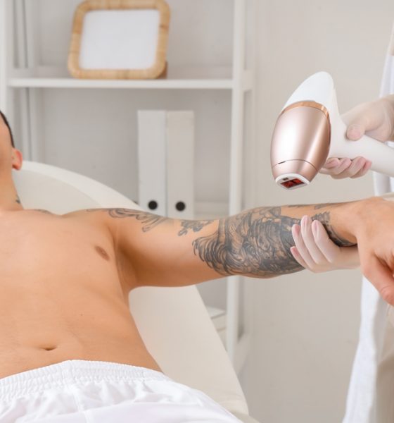 Fairfax, Virginia Tattoo Removal Cost