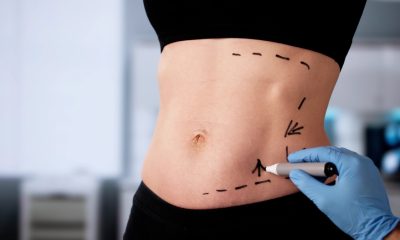 How to Find the Best Liposuction Surgery Prices in Scottsdale, Arizona 