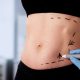 How to Find the Best Liposuction Surgery Prices in Scottsdale, Arizona 